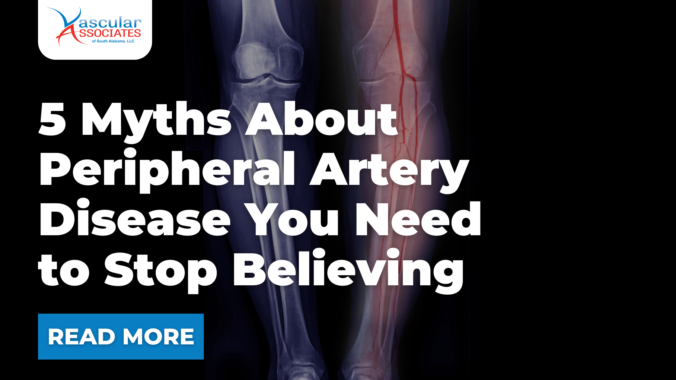 5 Myths About Peripheral Artery Disease You Need to Stop Believing.png